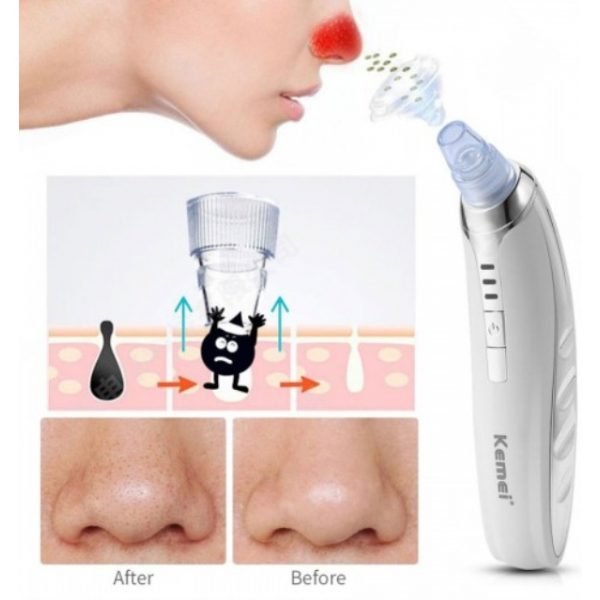Συσκευή για βαθύ καθαρισμό προσώπου - KM-1868 - Kemei - Image 4